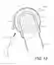 Fig. 14 - Medical device and procedure simulation and training