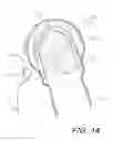 Fig. 15 - Medical device and procedure simulation and training