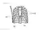 Fig. 11 - Thoracic cavity simulator