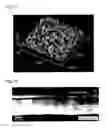 Fig. 11 - Underlayer for perpendicularly magnetized film, perpendicularly magnetized film structure, perpendicular MTJ element, and perpendicular magnetic recording medium using the same