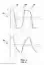 Fig. 05 - Method of producing plasma by multiple-phase alternating or pulsed electrical current