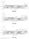 Fig. 09 - Land side and die side cavities to reduce package z-height
