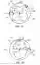Fig. 04 - SEMICONDUCTOR PACKAGE ASSEMBLY