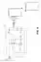Fig. 05 - Speakerphone system or speakerphone accessory with on-cable microphone