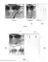 Fig. 05 - Encoding and decoding selectively retrievable representations of video content