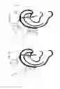 Fig. 08 - Hearing aid device comprising a sensor member