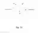 Fig. 14 - Hearing aid device comprising a sensor member