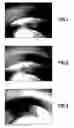 Fig. 02 - Method for treating seeds