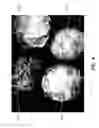 Fig. 05 - Superabsorbent polymer seed coatings and associated methods