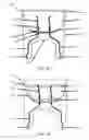 Fig. 02 - Hydro planter