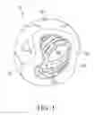 Fig. 02 - Shock absorbing cap