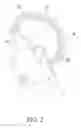 Fig. 03 - Shock absorbing cap