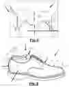 Fig. 06 - SHOE INSERT