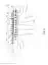 Fig. 05 - Oral care implement having multiple soft tissue cleaner components