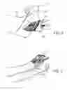 Fig. 06 - Transportation of Medical Instruments