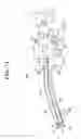 Fig. 07 - Laparoscopic device and endoscopic system