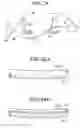 Fig. 32 - Laparoscopic device and endoscopic system