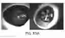 Fig. 45 - Apparatus, devices and methods for obtaining omnidirectional viewing by a catheter