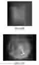 Fig. 48 - Apparatus, devices and methods for obtaining omnidirectional viewing by a catheter
