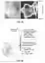 Fig. 51 - Apparatus, devices and methods for obtaining omnidirectional viewing by a catheter