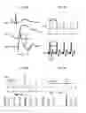 Fig. 03 - Device for measurement and evaluation of cardiac function on the basis of thoracic impedance