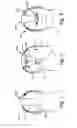Fig. 02 - EEG headsets with precise and consistent electrode positioning