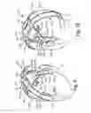 Fig. 06 - EEG headsets with precise and consistent electrode positioning