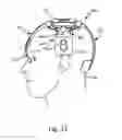 Fig. 07 - EEG headsets with precise and consistent electrode positioning