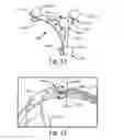 Fig. 08 - EEG headsets with precise and consistent electrode positioning