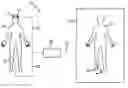Fig. 01 - Rehabilitation system and method