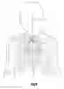 Fig. 08 - Catheter locator apparatus and method of use