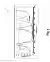 Fig. 02 - SYSTEMS AND METHODS FOR OPTICALLY GUIDED PLACEMENT AND MONITORING OF MEDICAL IMPLANTS