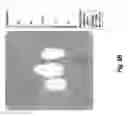 Fig. 11 - SYSTEMS AND METHODS FOR OPTICALLY GUIDED PLACEMENT AND MONITORING OF MEDICAL IMPLANTS