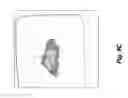 Fig. 12 - SYSTEMS AND METHODS FOR OPTICALLY GUIDED PLACEMENT AND MONITORING OF MEDICAL IMPLANTS
