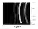 Fig. 22 - SYSTEMS AND METHODS FOR OPTICALLY GUIDED PLACEMENT AND MONITORING OF MEDICAL IMPLANTS
