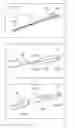 Fig. 04 - Medical device and method for producing a medical device