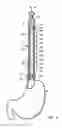 Fig. 02 - Method of detecting and measuring the condition of intraluminal esophageal mucosa