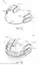 Fig. 14 - DETERMINING A LEVEL OF COMPLIANCE USING A DEVICE FOR TREATMENT OF DISORDERED BREATHING