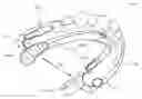 Fig. 01 - DETECTING AND TREATING DISORDERED BREATHING
