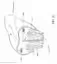 Fig. 04 - DETERMINING A TYPE OF DISORDERED BREATHING