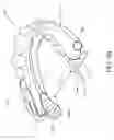 Fig. 07 - DETERMINING A TYPE OF DISORDERED BREATHING