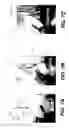 Fig. 10 - Tomosynthesis views from cone beam computed tomography data