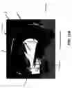 Fig. 19 - Tomosynthesis views from cone beam computed tomography data