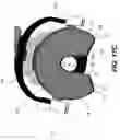 Fig. 27 - Tomosynthesis views from cone beam computed tomography data