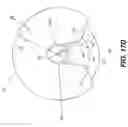 Fig. 28 - Tomosynthesis views from cone beam computed tomography data