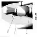 Fig. 33 - Tomosynthesis views from cone beam computed tomography data