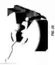 Fig. 34 - Tomosynthesis views from cone beam computed tomography data