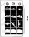 Fig. 40 - Tomosynthesis views from cone beam computed tomography data