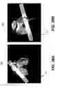 Fig. 41 - Tomosynthesis views from cone beam computed tomography data