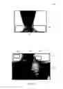 Fig. 03 - Systems and methods for X-ray image pasting